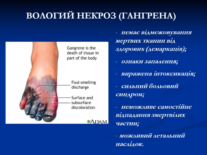 ВОЛОГИЙ НЕКРОЗ (ГАНГРЕНА) немає відмежовування мертвих тканин від здорових (демаркація); ВОЛОГИЙ НЕКРОЗ (ГАНГРЕНА) немає відмежовування мертвих тканин від здорових (демаркація);